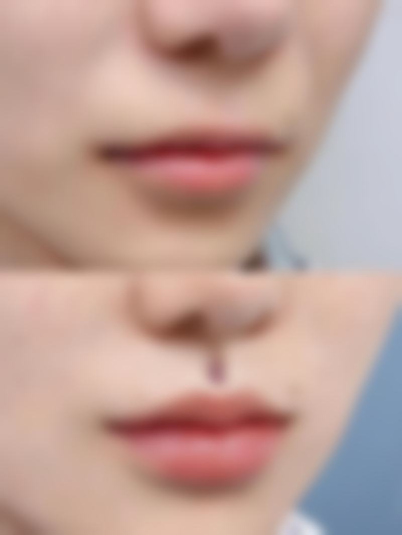 五、临沂炫颜医疗美容诊所收费价格表