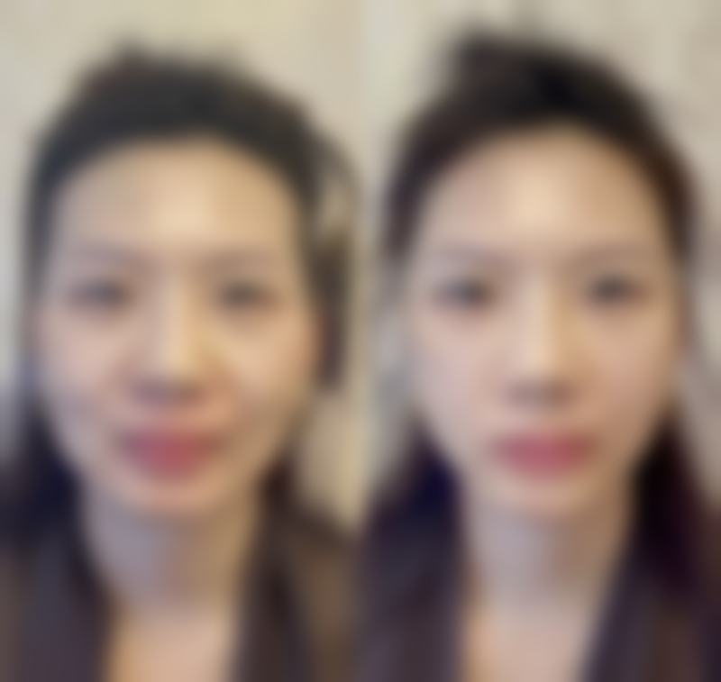 四、南宁奢美妍医疗美诊所特色项目