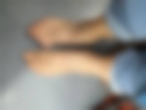 隆胸的后遗症有哪些?危害大不大？详解假体与自体脂肪隆胸后遗症，多数风险可控！ 