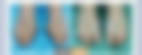 四、DMTC美容皮肤科特色项目