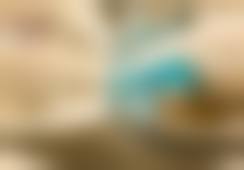 六、太原美媛荟整形美容上田宽医生口碑评价及真人实例反馈