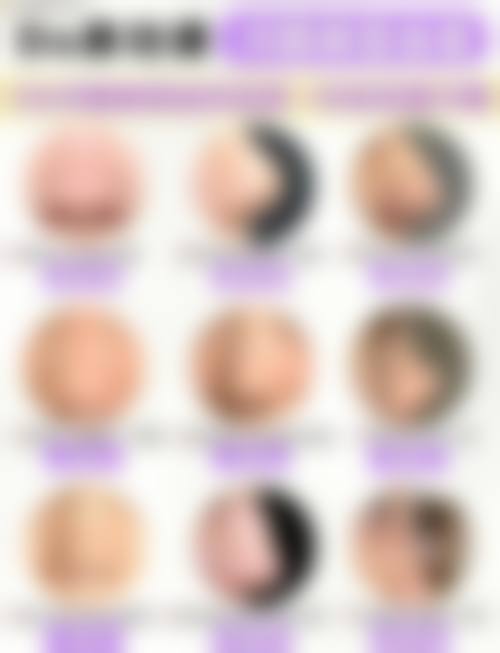 四、北京漾缇医疗美容诊所特色项目