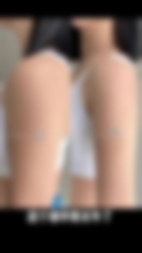 四、武汉臻妍颂医疗美容门诊部特色项目