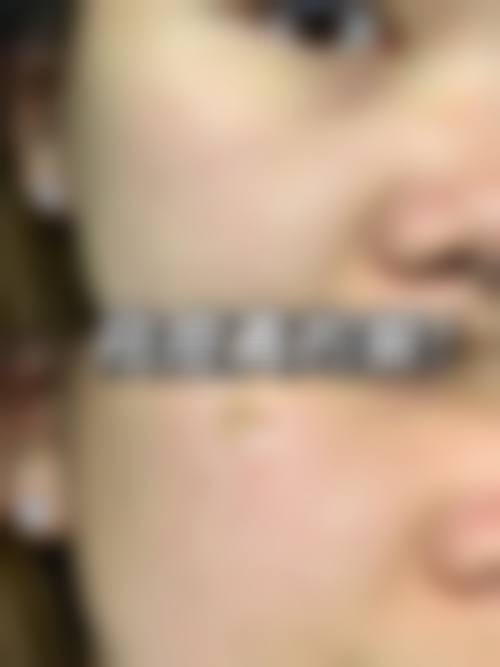 五、广州名美汇医疗美容门诊部收费价格表