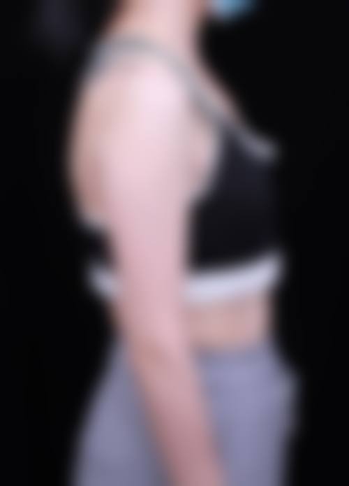 八、西安众山臻美医疗美容门诊部怎么预约?