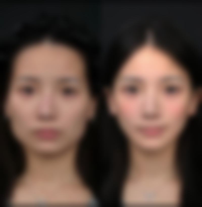 八、南昌甄美医疗美容医院怎么预约?