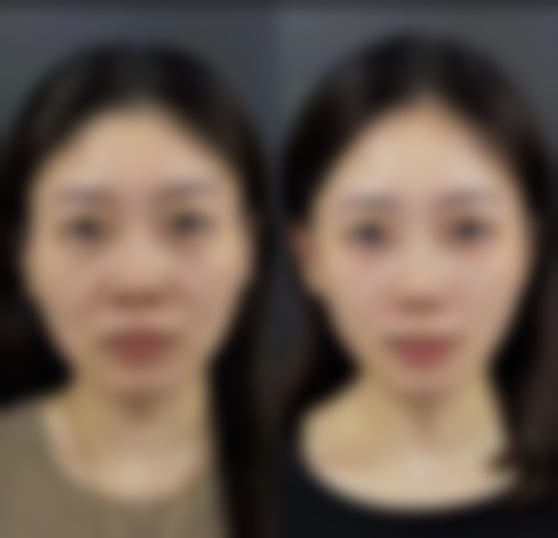 五、宁夏华美整形美容医院口腔科（银川华美口腔）收费价格表