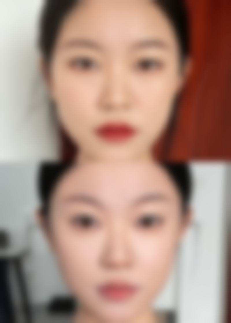 不同修复阶段晒太阳的时间建议