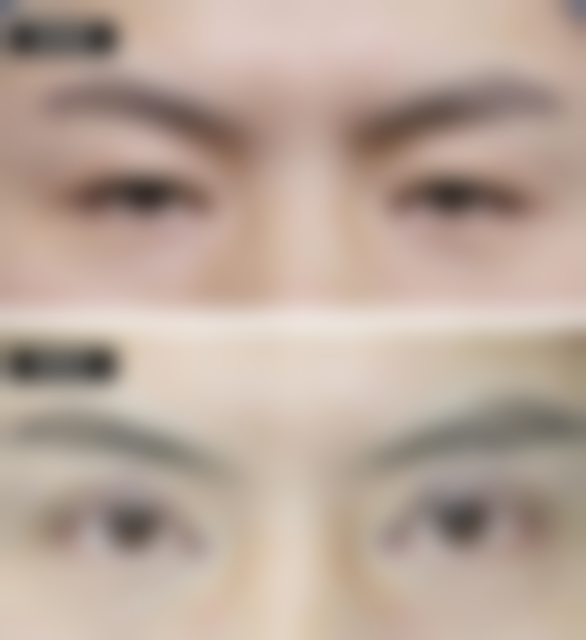 五、南昌甄美医疗美容医院收费价格表