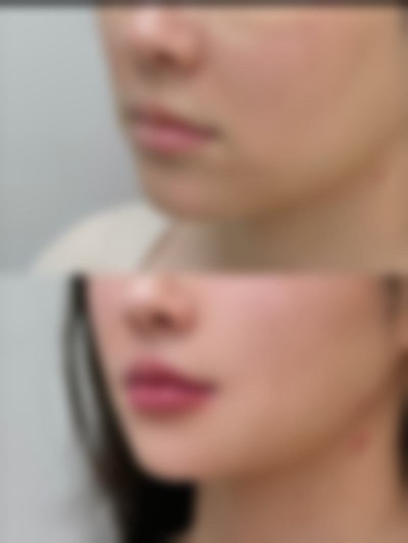 六、DMTC美容皮肤科口碑如何?