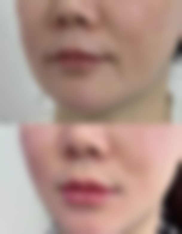 六、广州名美汇医疗美容门诊部口碑如何？