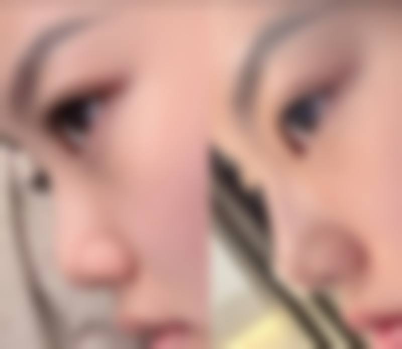 四、西安丽樽医疗整形美容医院特色项目