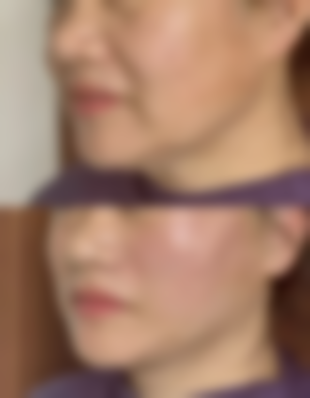 五、宁波爱美丽医疗美容诊所收费价格表