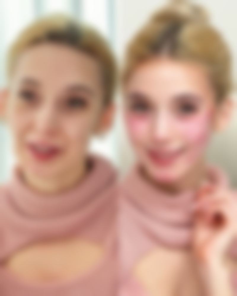 阴道缩小手术有危害吗？潜在危害需知晓