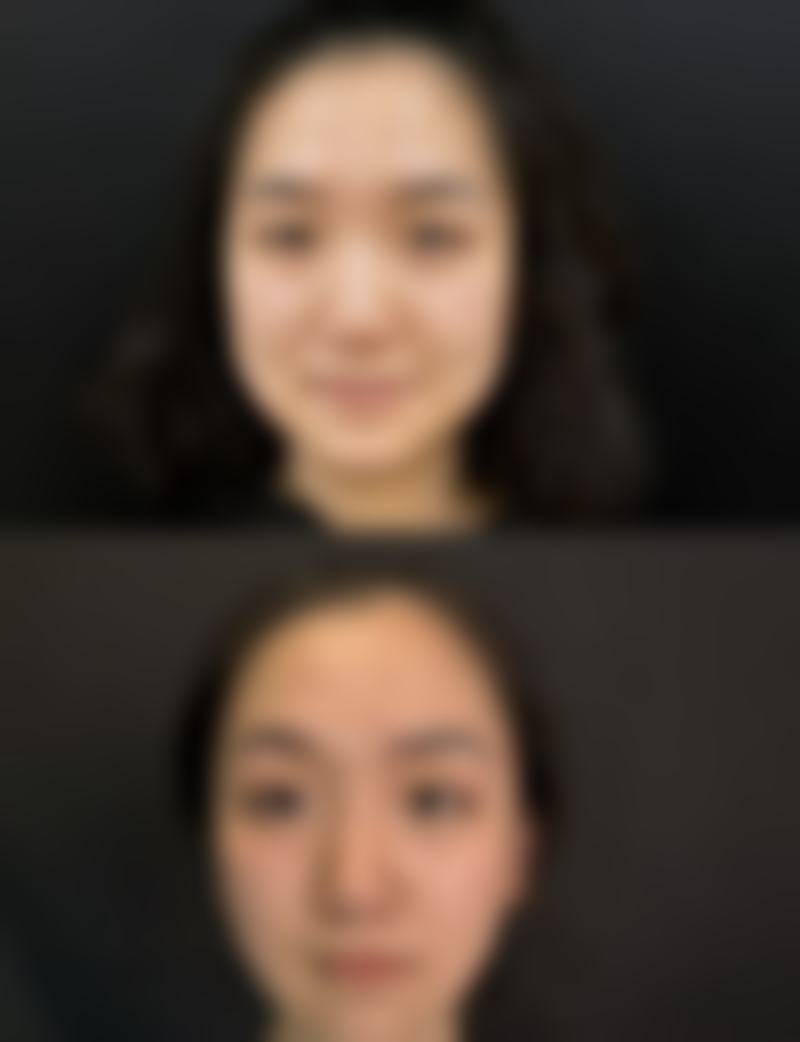 六、江西 南昌阅美医疗美容口碑如何？