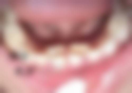 六、邯郸邱县中 心苏晓利医生口碑评价及真人实例反馈