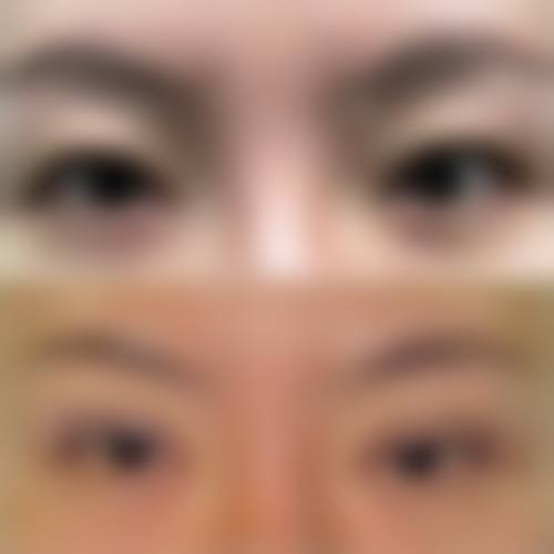 四、厦门安黛美整形医疗美容医院特色项目