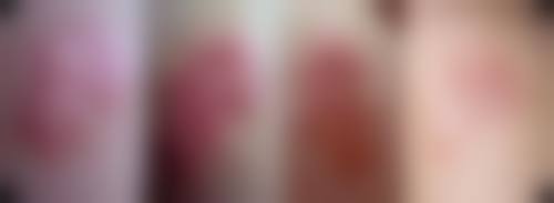 八、益阳市中 心医院整形烧伤科怎么预约？