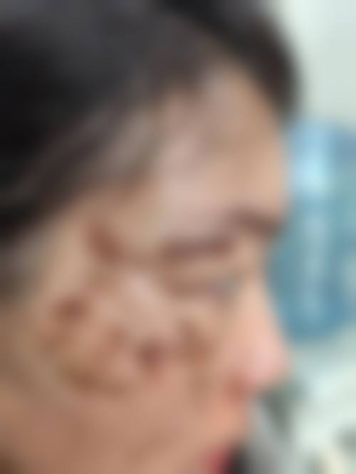 五、长沙市星辰星医美医疗美容门诊部收费价格表