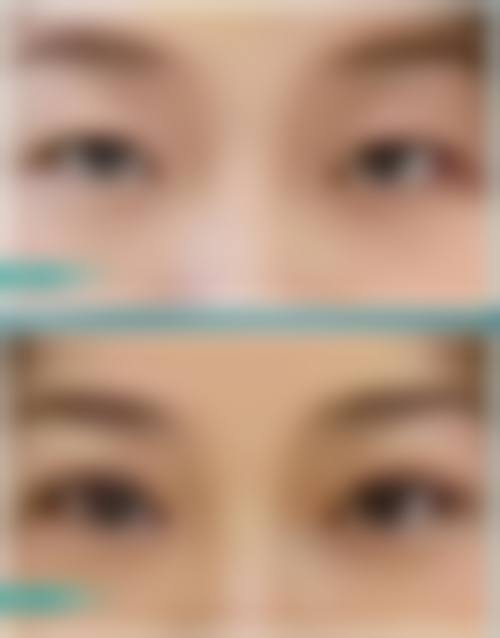 六、韩国Glowell整形医院口碑如何？