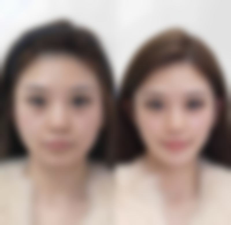 五、天津福斓医疗美容门诊收费价格表