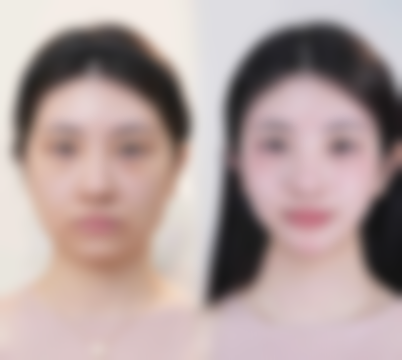 六、西安晗美医疗美容门诊部口碑如何？