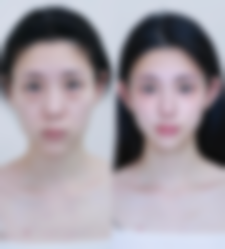 六、西安健丽整形美容医院口碑如何？