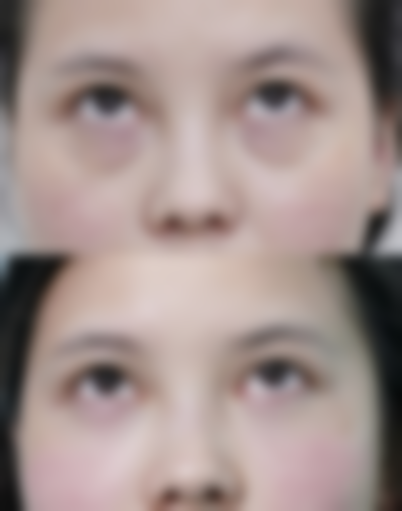 六、威海百颜医疗美容整形门诊部口碑如何?