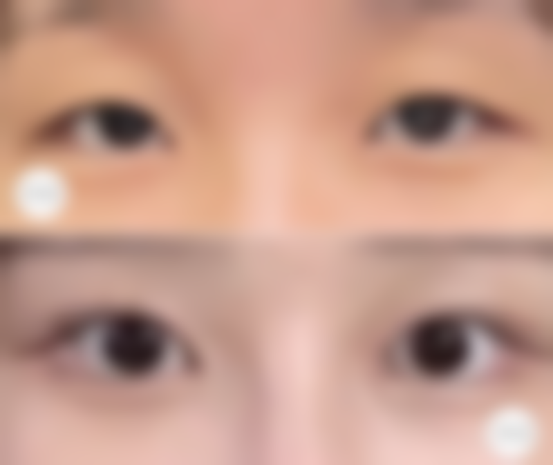 四、广州古汀医疗美容门诊部特色项目