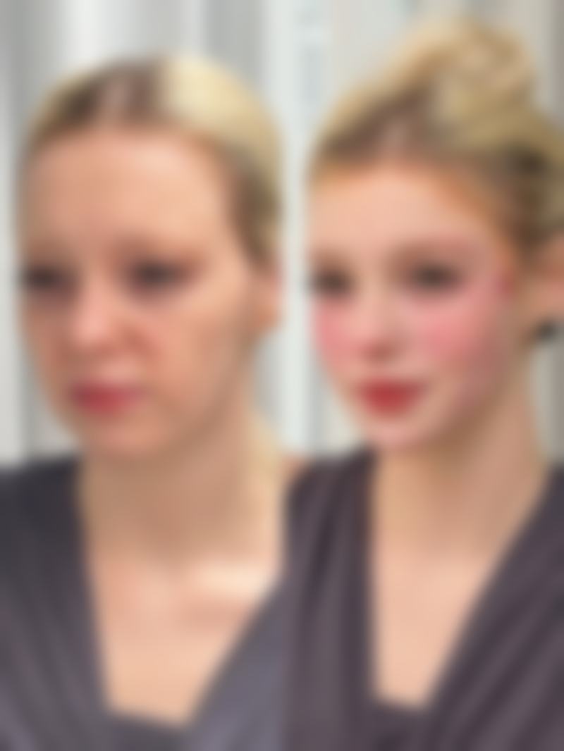 手术做眼袋可以管多久？受手术方式、个人体质等因素影响，一般能保持5到10年！ 