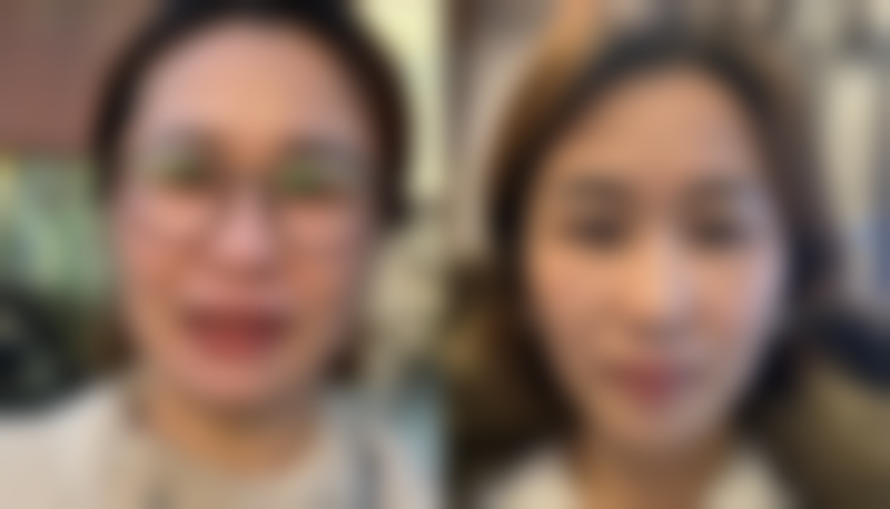 四、Vent Vert Clinic 高槻特色项目