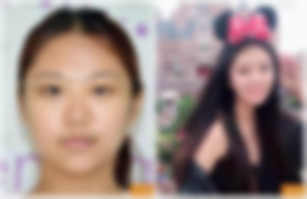 北京禾美嘉医疗美容余班林医生怎么预约？