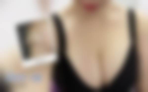 北京禾美嘉医疗美容余班林医生擅长项目