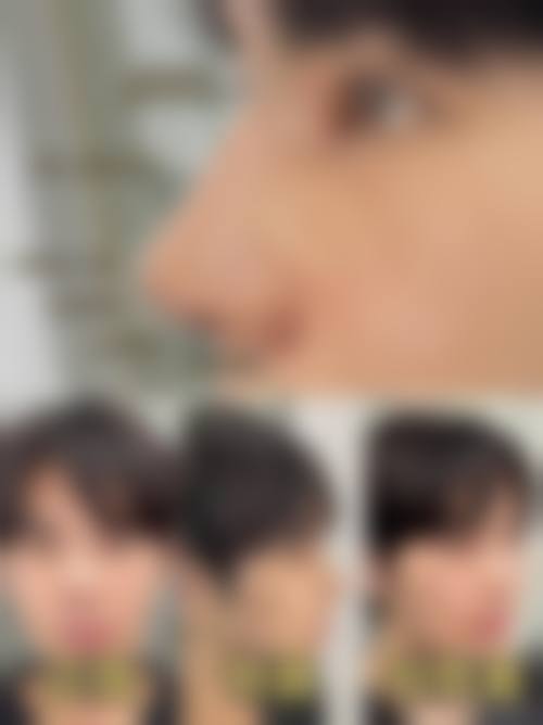 六、上海愉悦美联臣整形医疗美容医院口碑如何？