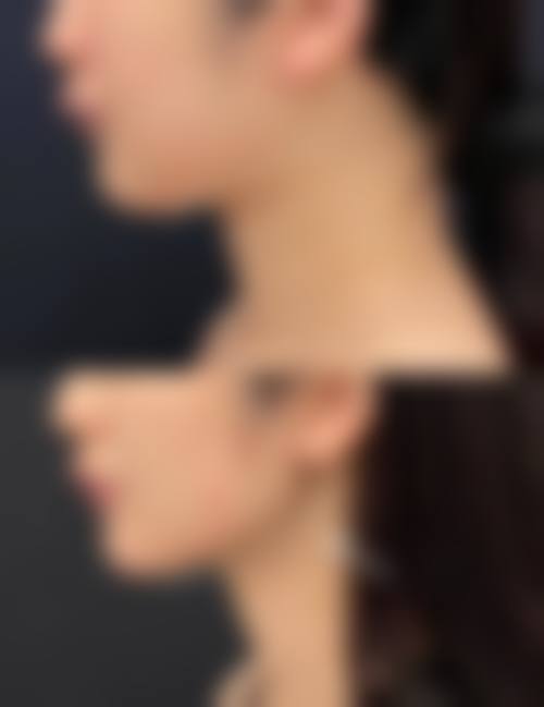 八、福清市医院(整形外科)怎么预约?