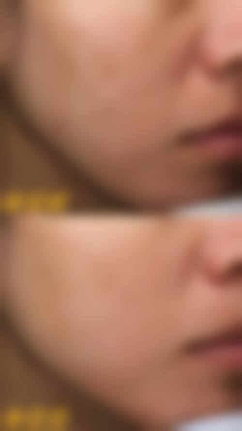 四、韩国清潭minit医院特色项目