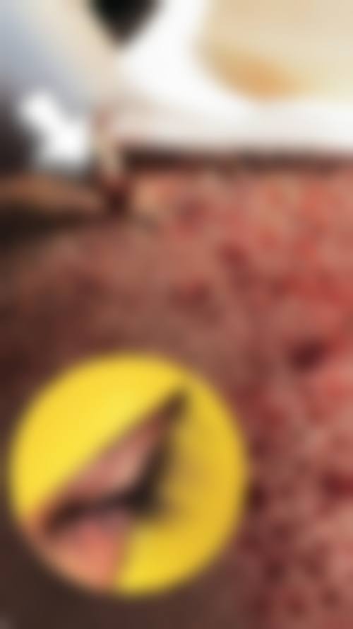 六、上海馥兰朵植发中 心口碑如何?