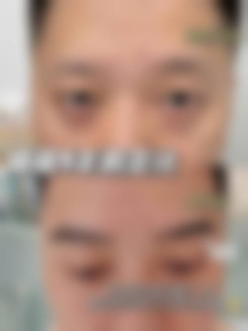 五、上海馥兰朵植发中 心收费价格表