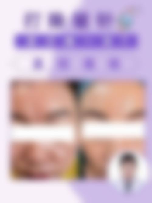 四、烟台市莱阳中 心医院烧伤整形科特色项目