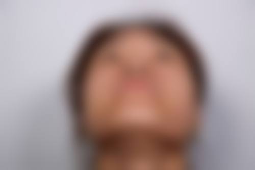 四、成都柔伊医疗美容门诊部特色项目