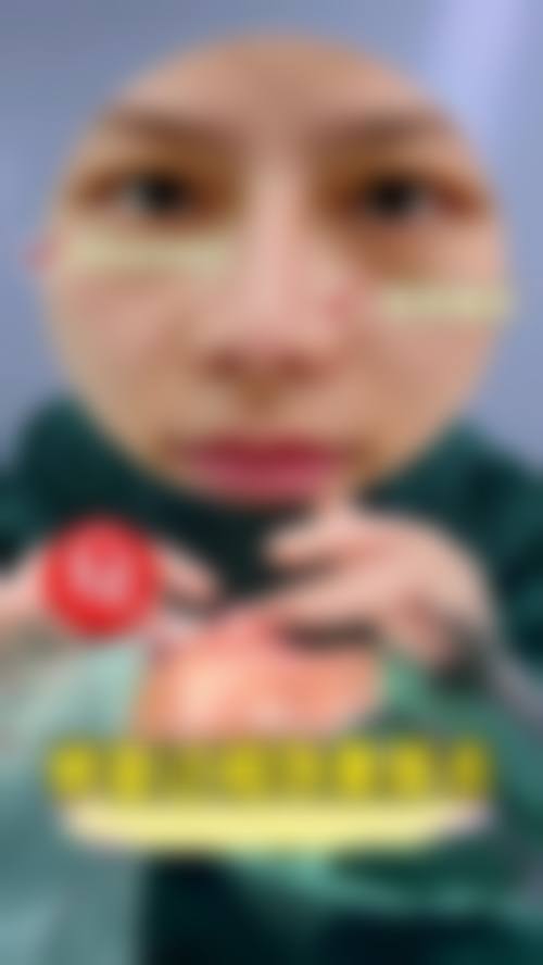 五、上海愉悦美联臣整形医疗美容医院收费价格表