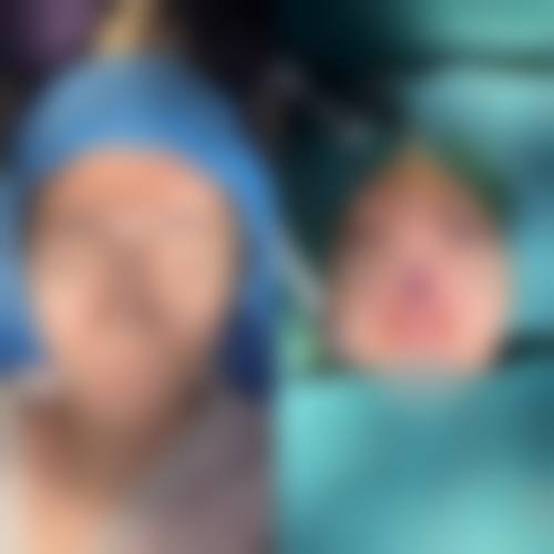 六、韩国DREAM梦想整形外科医院口碑如何?