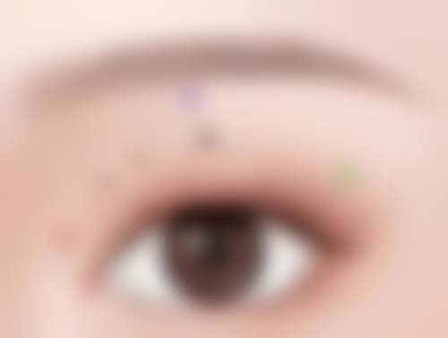 五、成都素美医疗美容杨迪医生技术怎么样？