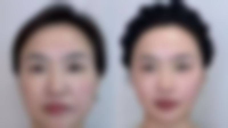 八、瑞昌禾本整形医院怎么预约？