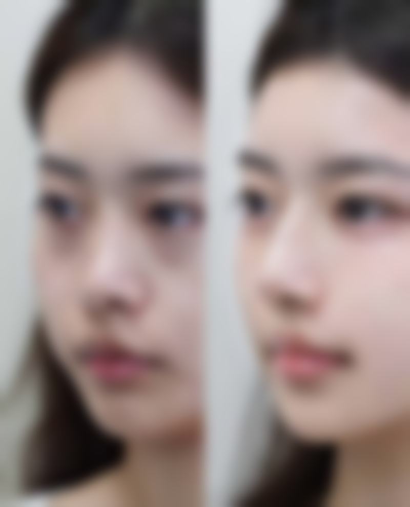 四、湘潭阳光医疗美容特色项目