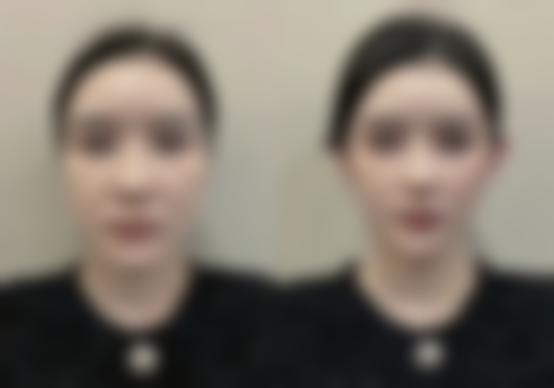 四、北京石榴医疗美容诊所特色项目