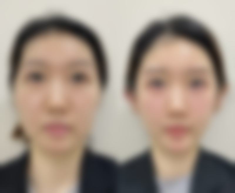 六、清潭jionu皮肤科口碑如何?