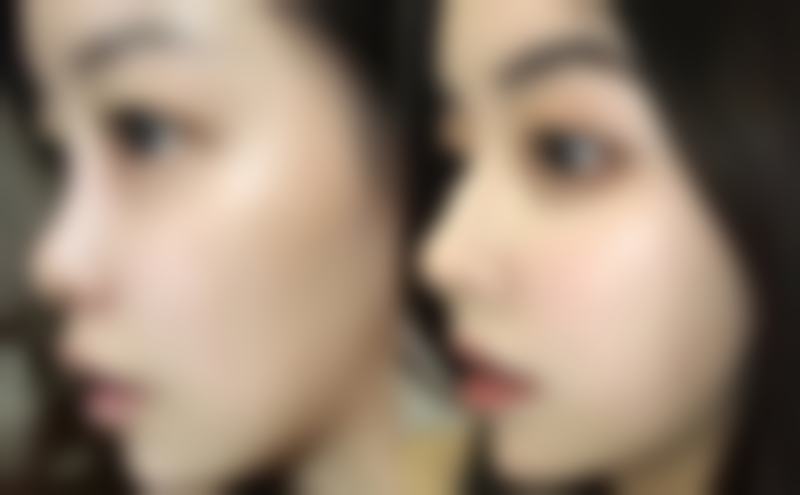 八、清潭jionu皮肤科怎么预约?