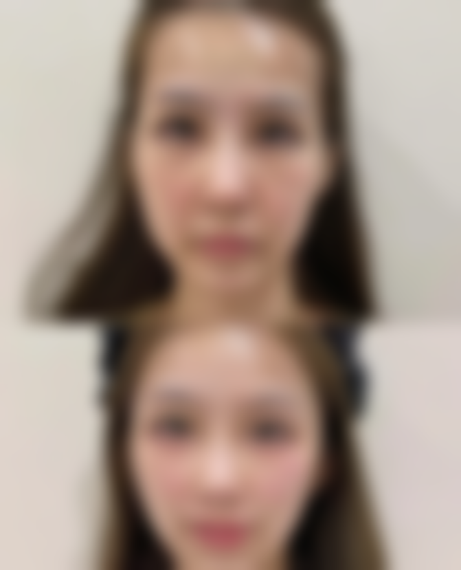 二、成都科思研医学美容赵泽方医生擅长项目