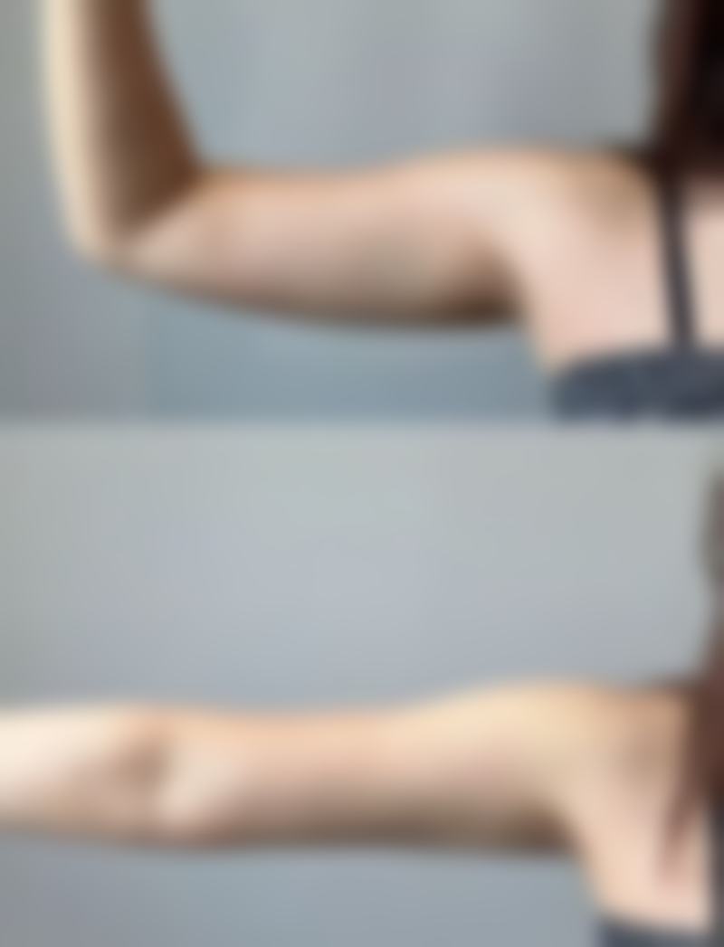 隆胸年龄多大适合？一般在18 - 50岁较合适，但还需结合身体、心理等状况综合考量！ 